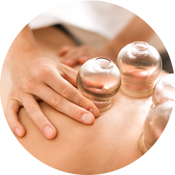 Cupping Therapy